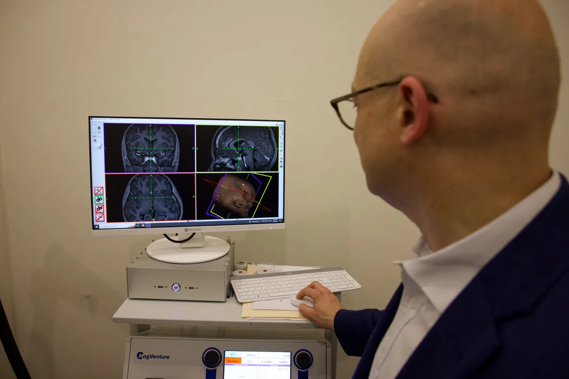 Clinician reviewing MRI brain scans on screen while planning an MRI-guided TMS treatment